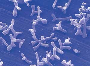 bifidobacterium - Pasteur Brewing