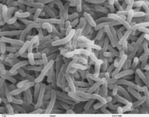 Cholera bacteria