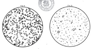 Lactic Acid - Microscopic beer samples