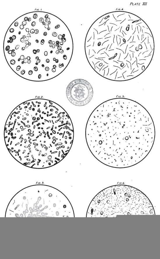 Lactic Acid - Microscopic Beer Samples